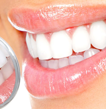 Teeth Whitening